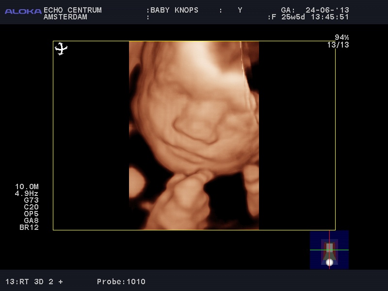 BABY-_KNOPS_20130624_RT-_3D-_2-_-R_0049