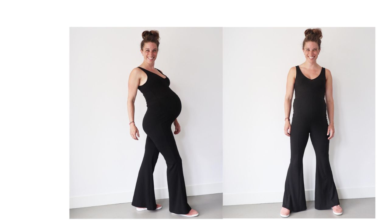 voorbereiden op geplande keizersnede drs Mama